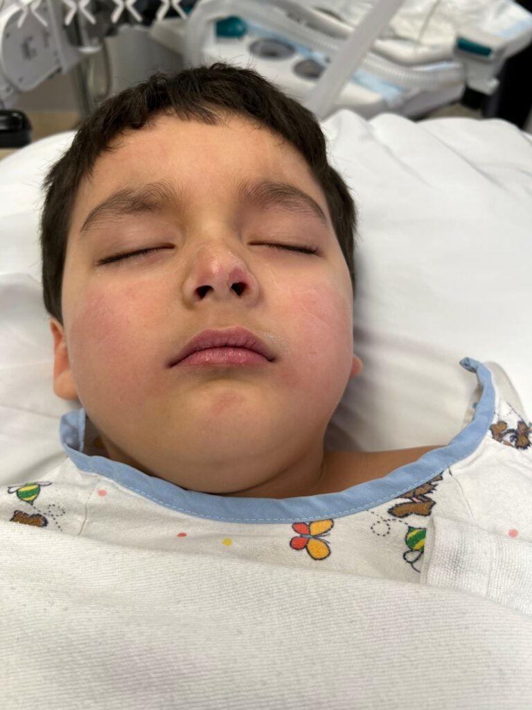 Induction in the operating room, nasal intubation with throat pack in place and post-extubation prior to transfer to the recovery room.
