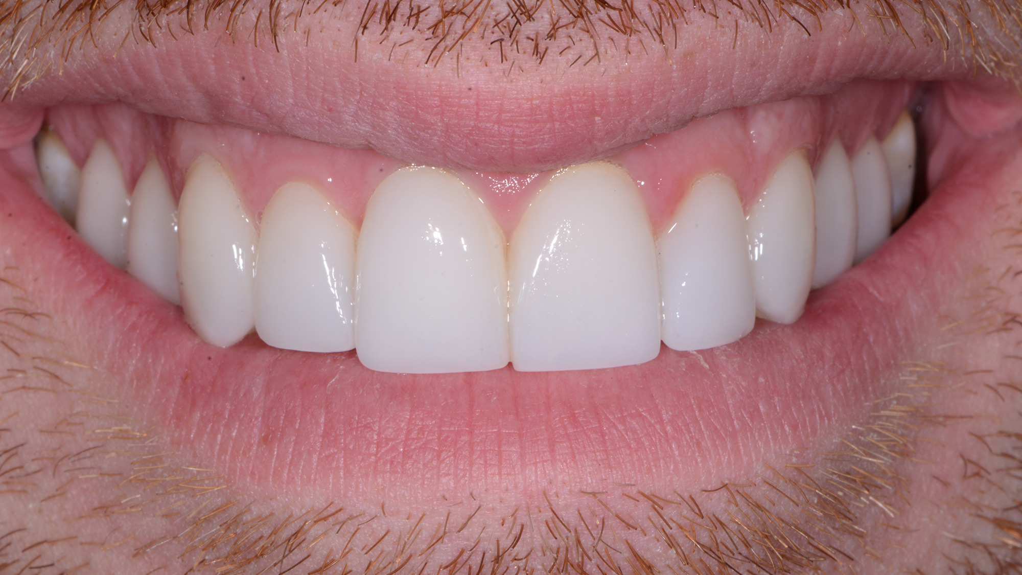 Cosmetic Dentistry
