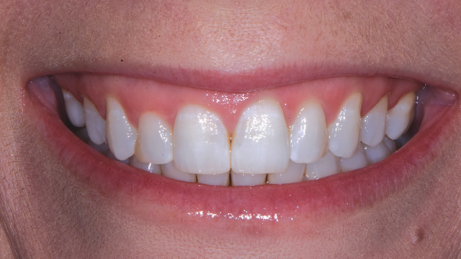 SMILE DESIGN